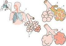 Astma, COPD en mucoviscidose